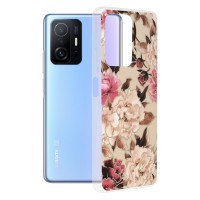 Techsuit Marble Back Cover voor Xiaomi 11T / 11T Pro - Mary Berry Nude